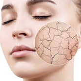Dermaccina Moisturizing Cream mejora la resequedad de la piel